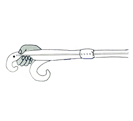 Diagram of Uterine Horn