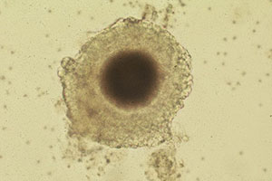Bovine oocyte Surrounded by Cumulus Cells Bovine oocyte Surrounded by Cumulus Cells