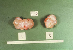corpus luteum corpus luteum