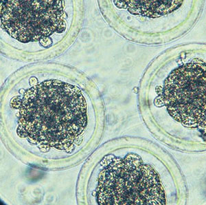 Practical Strategies Which Can Be Used to Enhance Embryo Survival Rates Practical Strategies Which Can Be Used to Enhance Embryo Survival Rates